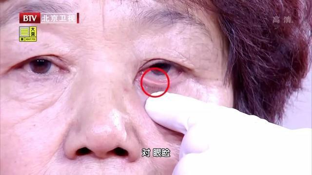 啄木鸟 ts 啄木添加了静态类型系统