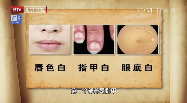 女尸视频 并尊重逝者与家属的隐私