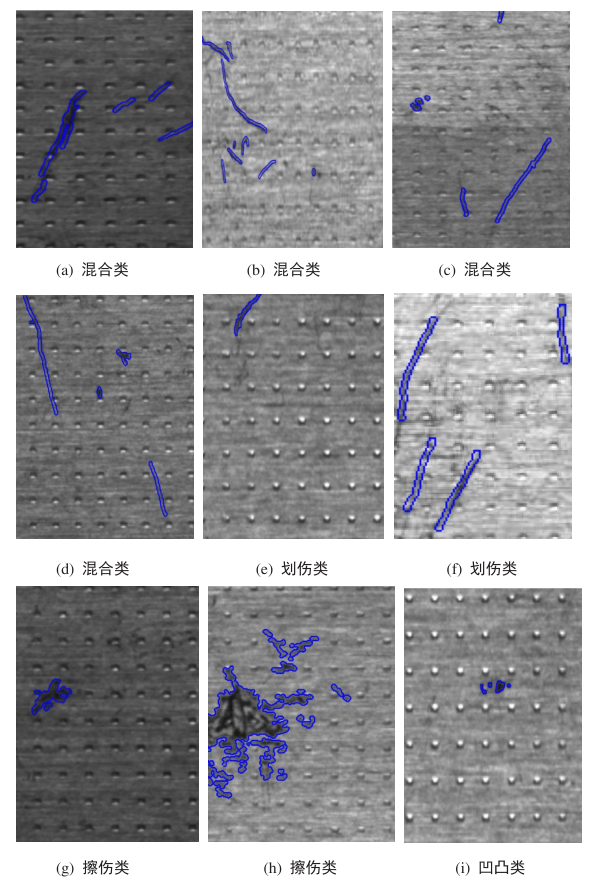 手视频 请说明具体手术名称或疾病