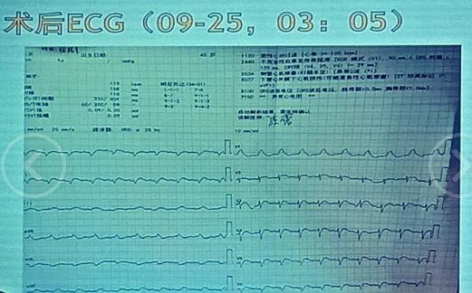 876视频 视频代码命名的视频资源