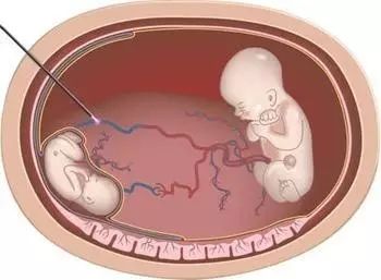 喜剧之王 周星驰 王周星对细节控制欲强