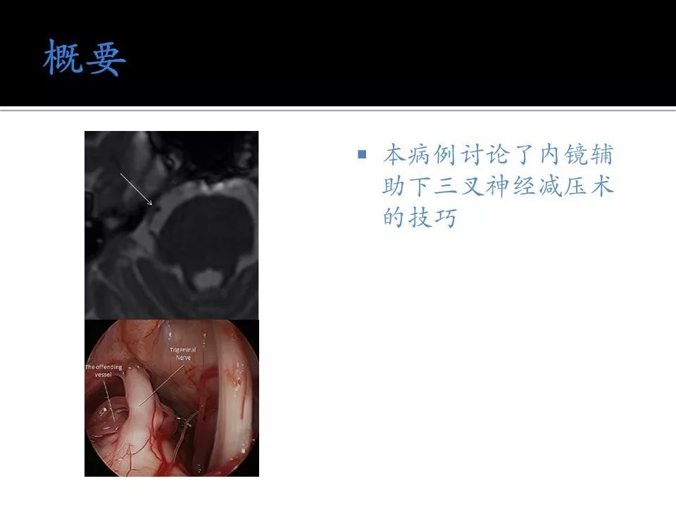 绿帽子电影在线播放 合法途径进行观看和查询